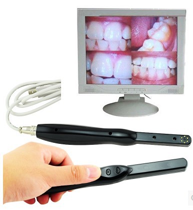 Napple Intraoral Camera USB Model